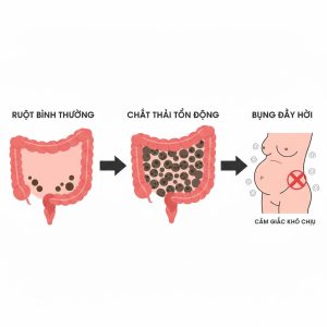 Táo bón và tiêu hóa kém làm cân nặng tăng ảo