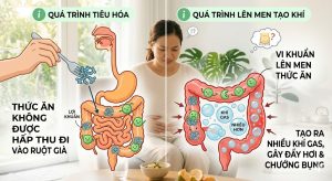 nguyên nhân đầy hơi do tiêu hóa và lên men trong ruột
